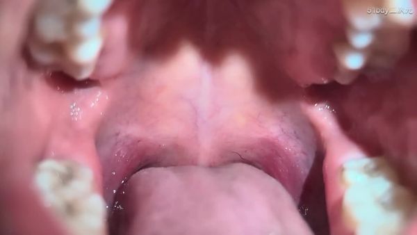 酥小熹 略感不适 请慎看「后置+闪光灯」口腔“内部”检查